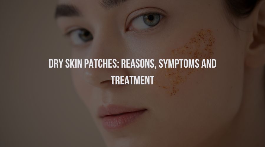 Dry Skin Patches: Reasons, Symptoms, and Treatment
