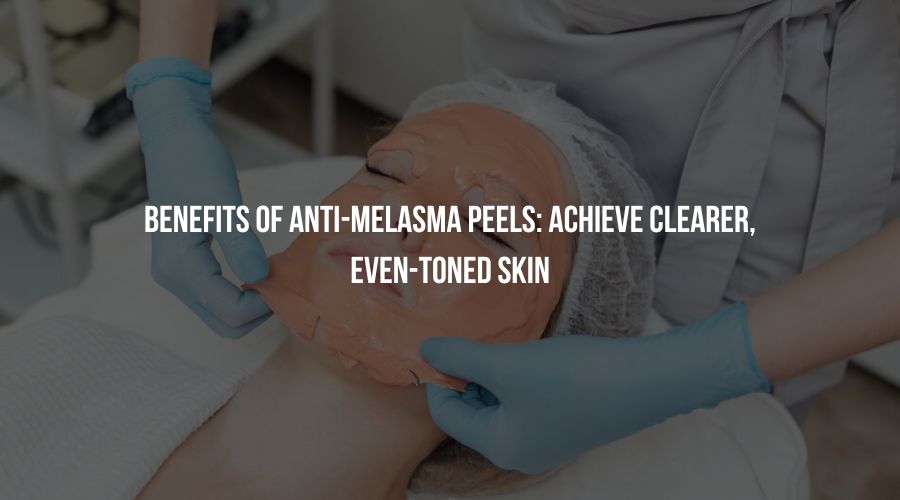 Benefits of Anti-Melasma Peels: Achieve Clearer, Even-Toned Skin