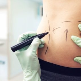 Bust contouring treatment​