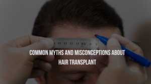 Common Myths and Misconceptions About Hair Transplant